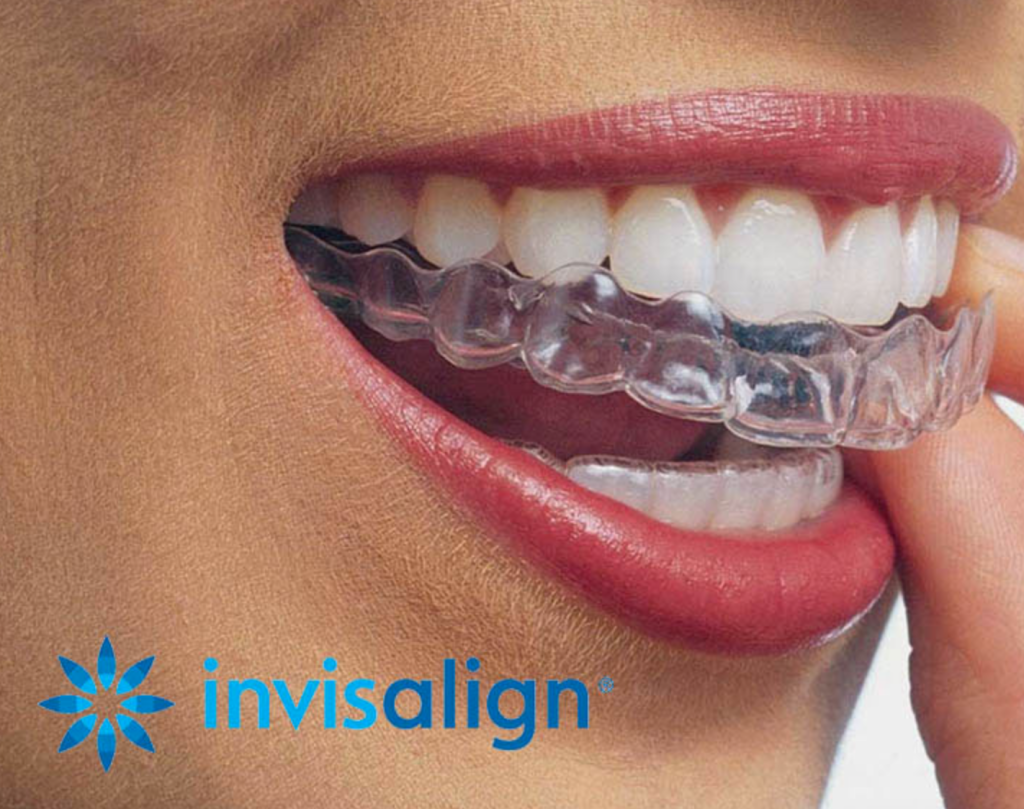 Invisalign Barcelona