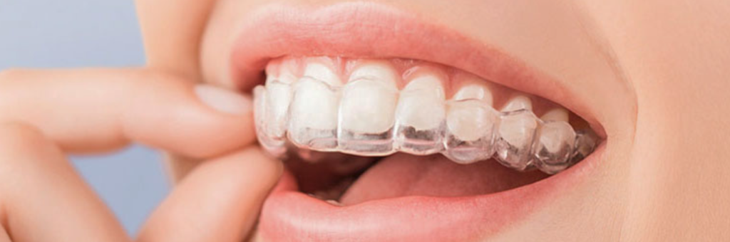implante ortodoncia