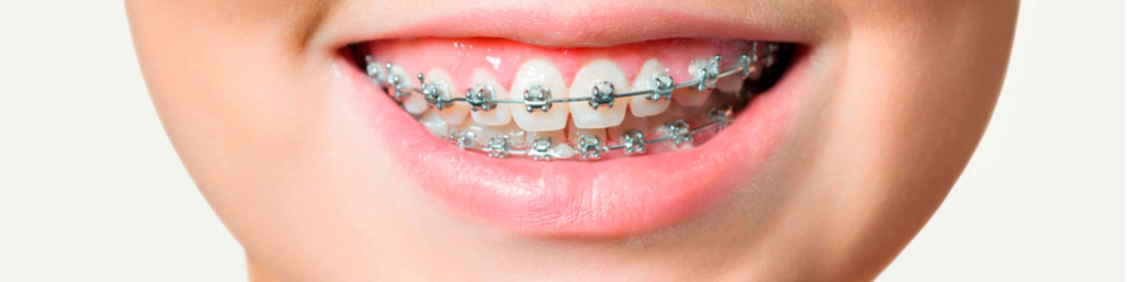 implante ortodoncia