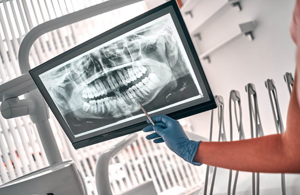 radiografías dentales odontología
