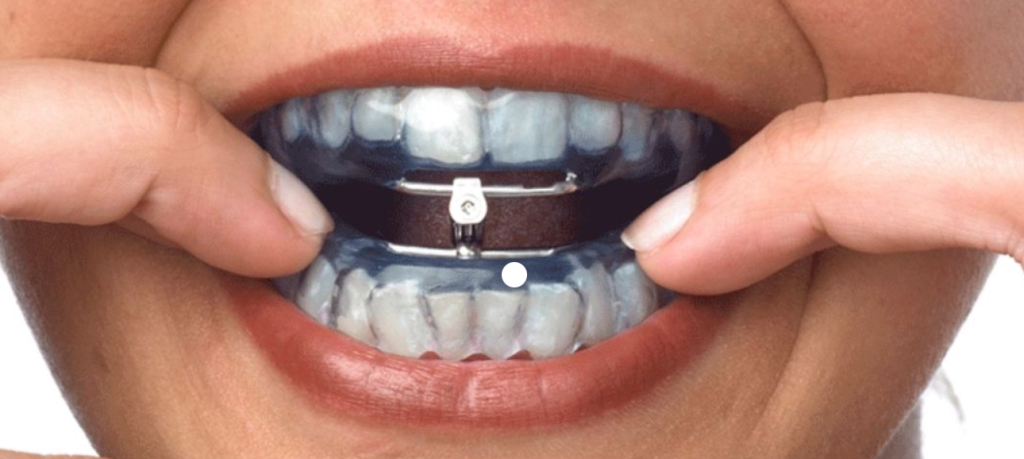 DAM dentista para ronquidos
