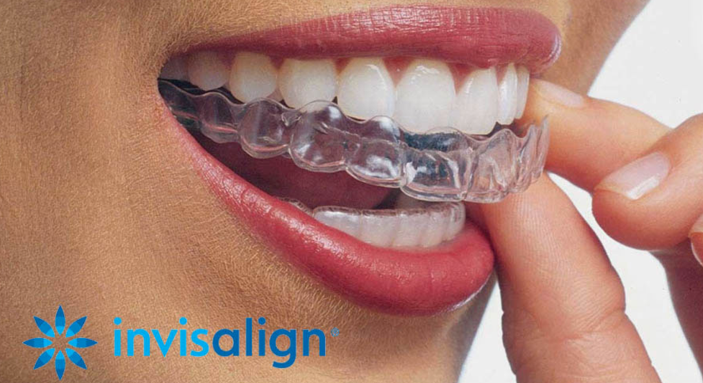 Invisalign Barcelona 2023