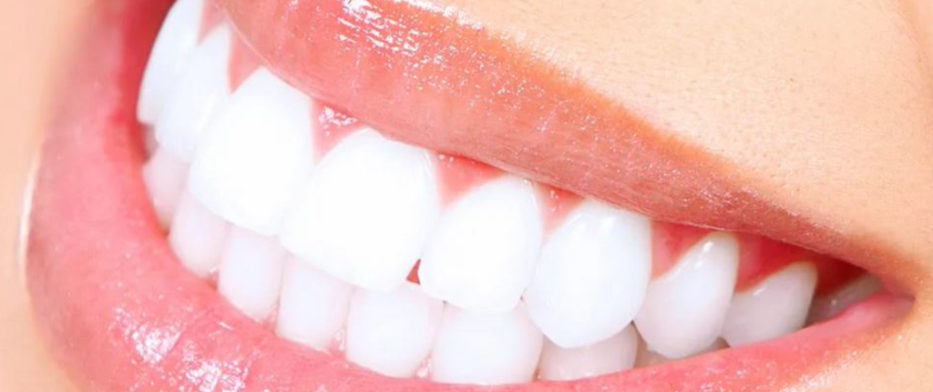 Trucos dientes blancs