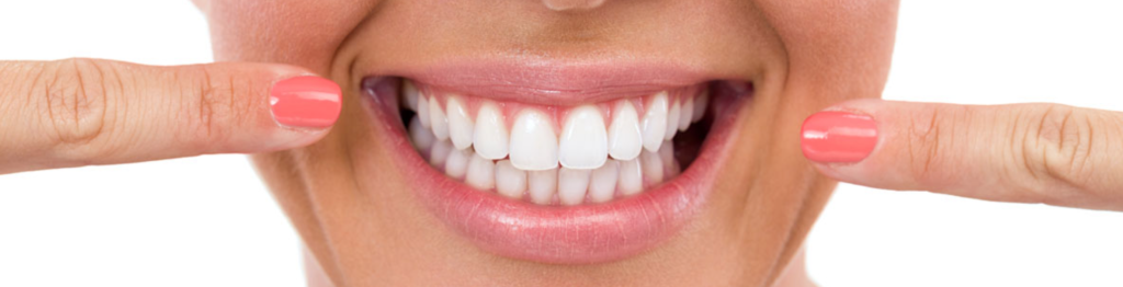 Blanqueamiento dental