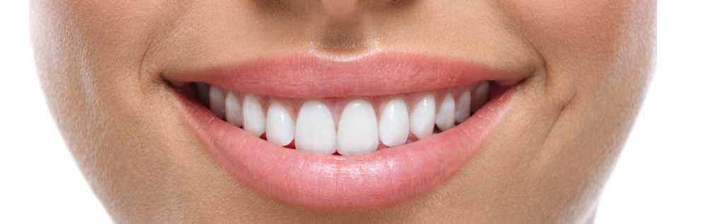 Tratamiento dientes oscuros Barcelona