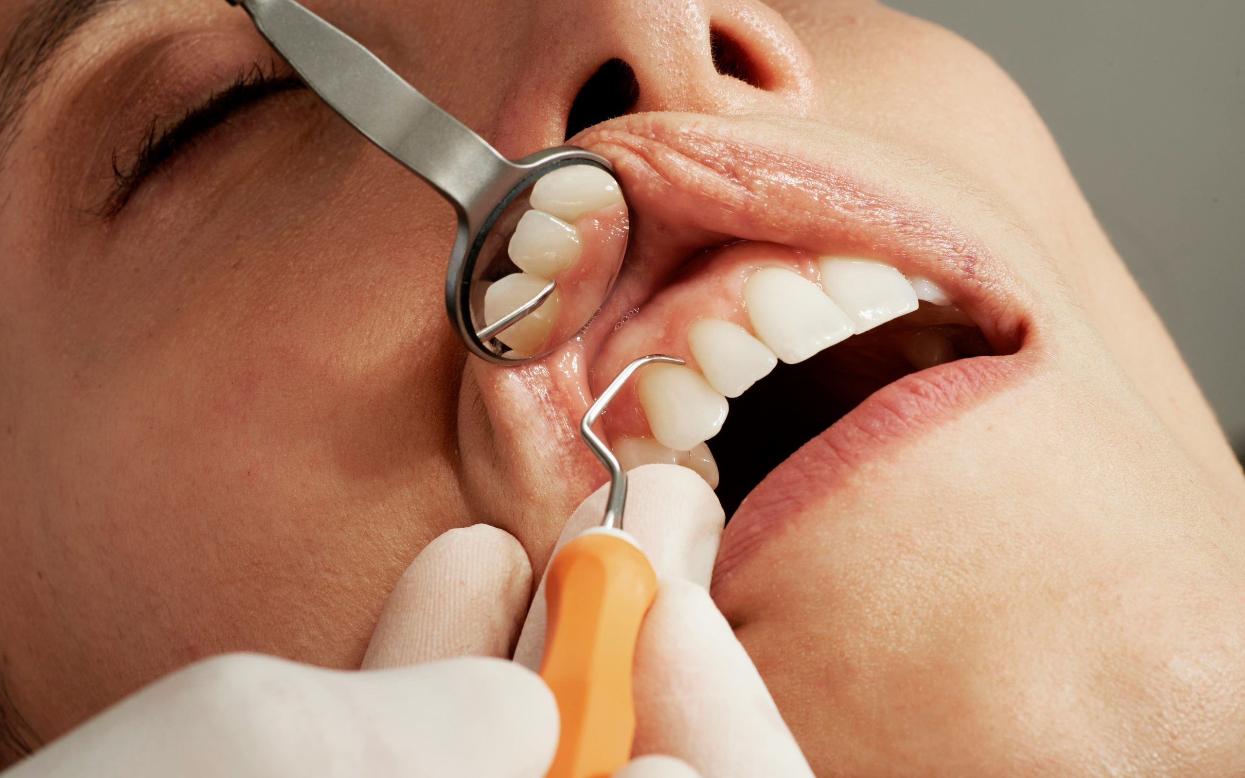 ¿Qué es la periodoncia y cómo ayuda a mantener las encías saludables?