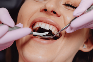 Síntomas y causas de la hipoplasia dental ¿cómo afecta tu sonrisa