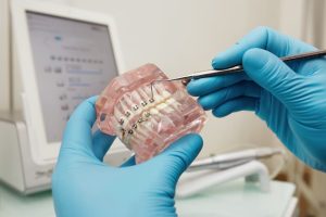Cómo elegir el mejor tipo de ortodoncia según tu caso